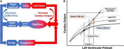 Weaning from venous-arterial extracorporeal membrane oxygenation: The hemodynamic and clinical aspects of flow challenge test